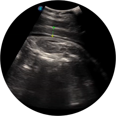horse ultrasound